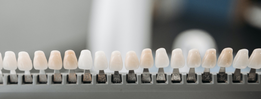 Teeth Whitening in Newcastle