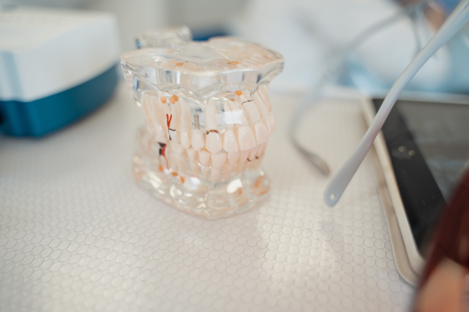 Cosmetic Dentistry in Newcastle