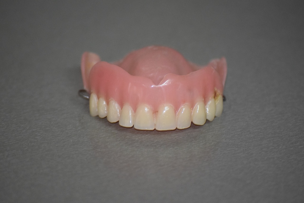 Dental Implants in Newcastle