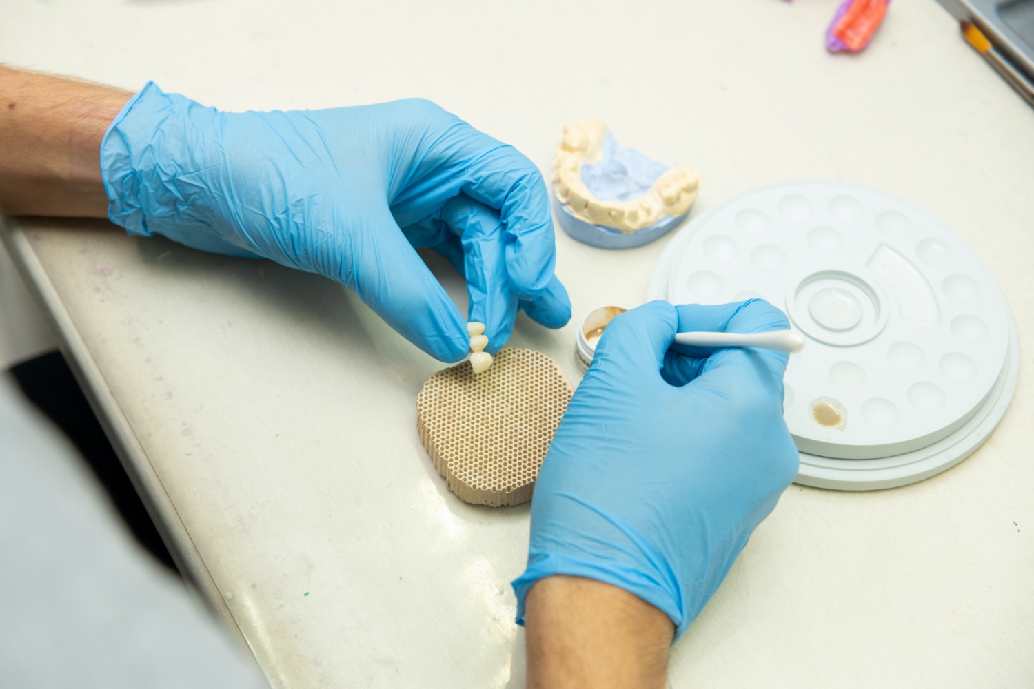 Dental Implants Newcastle