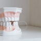Dental Implants Newcastle