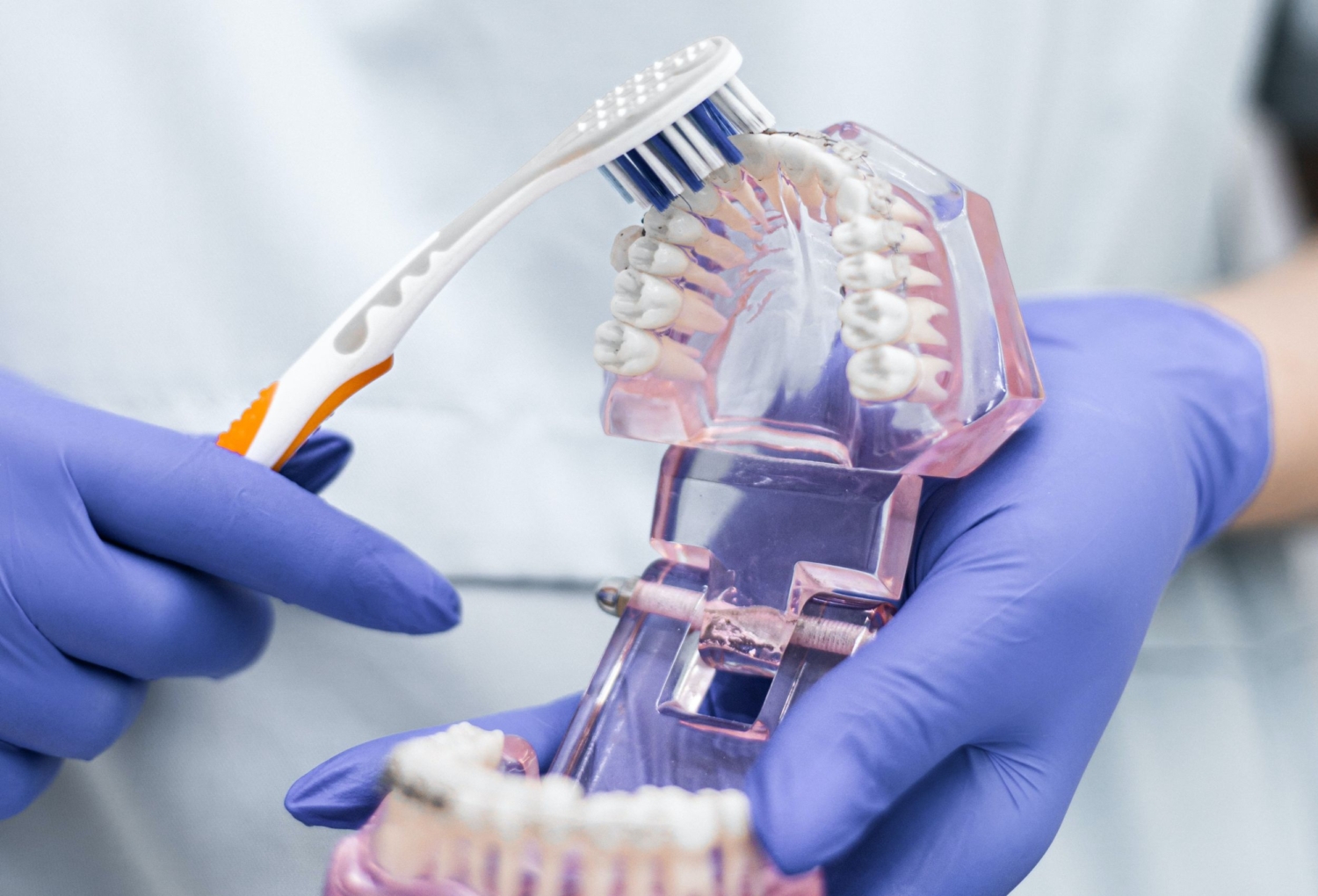 Teeth Whitening Newcastle