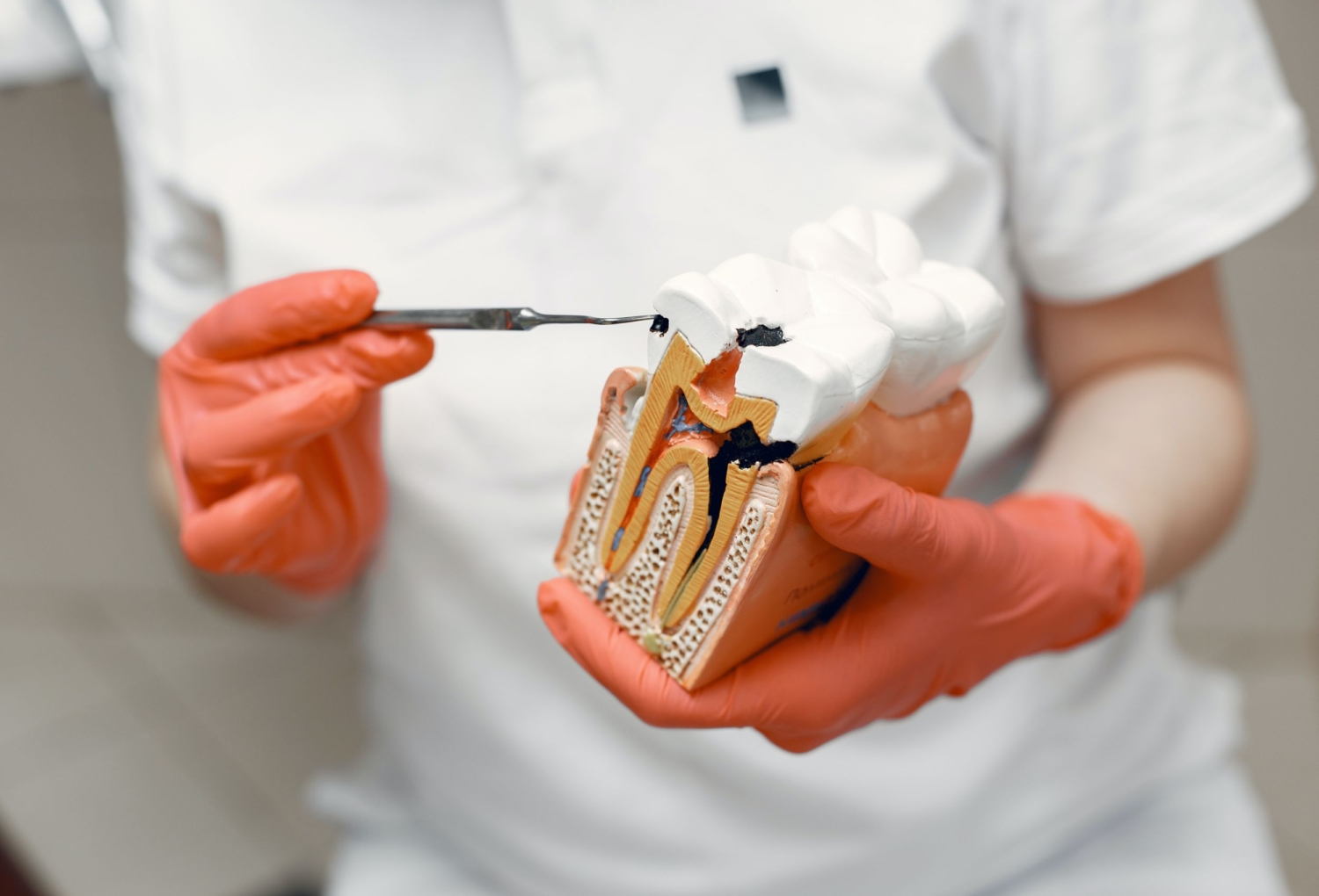 Dental Implant Newcastle