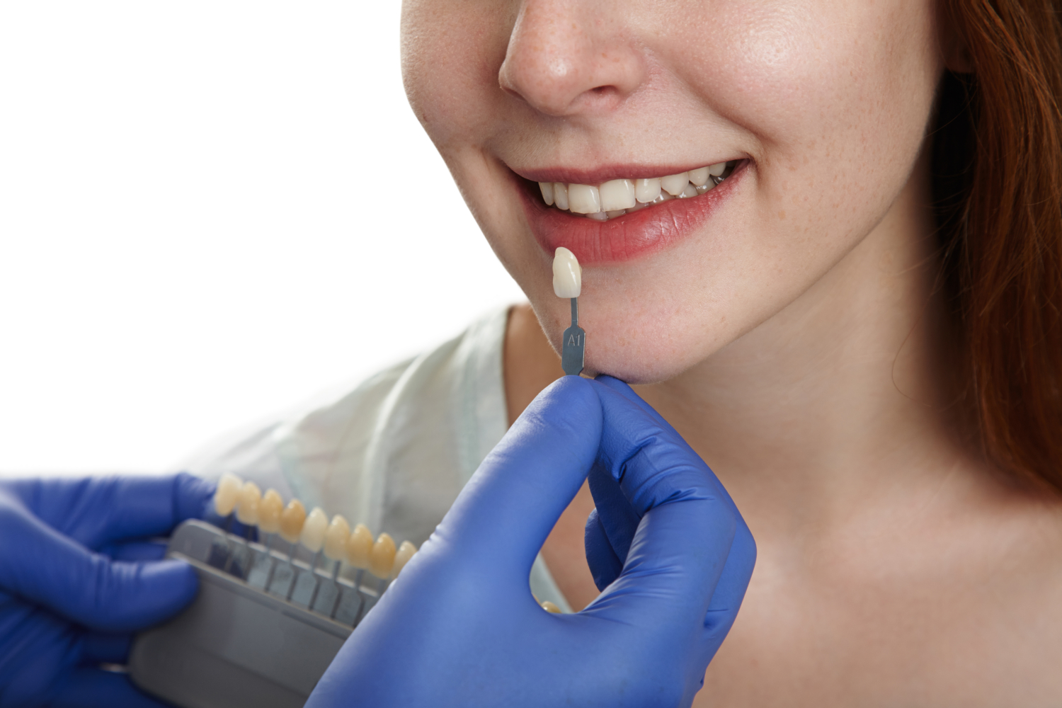 Cosmetic Dentistry Newcastle