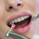 Teeth Whitening Newcastle