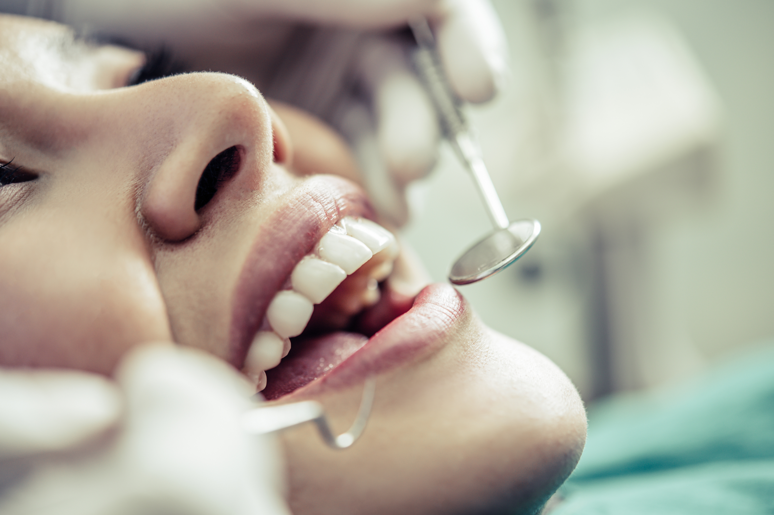 Teeth Straightening Newcastle