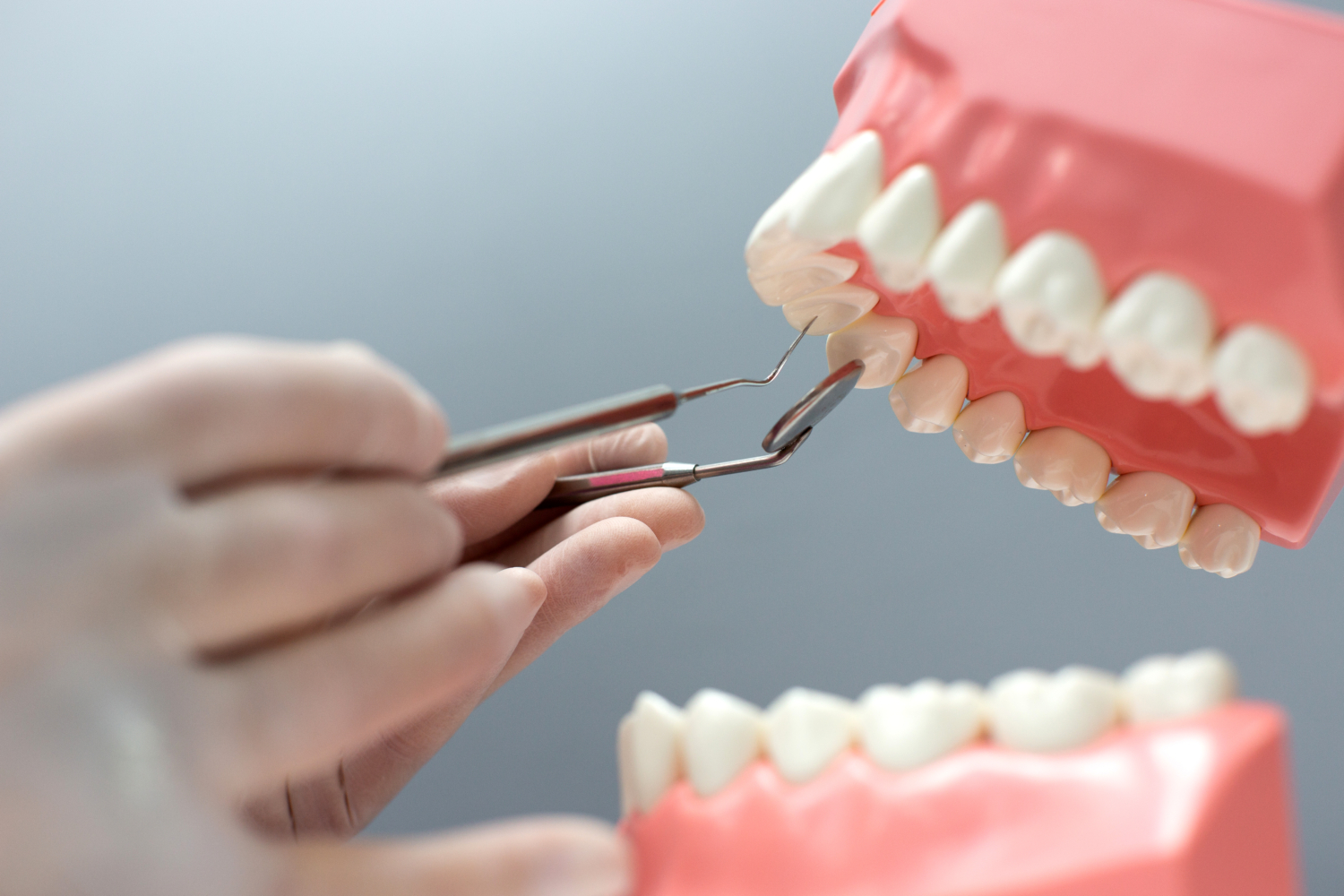 Dental Implant Newcastle