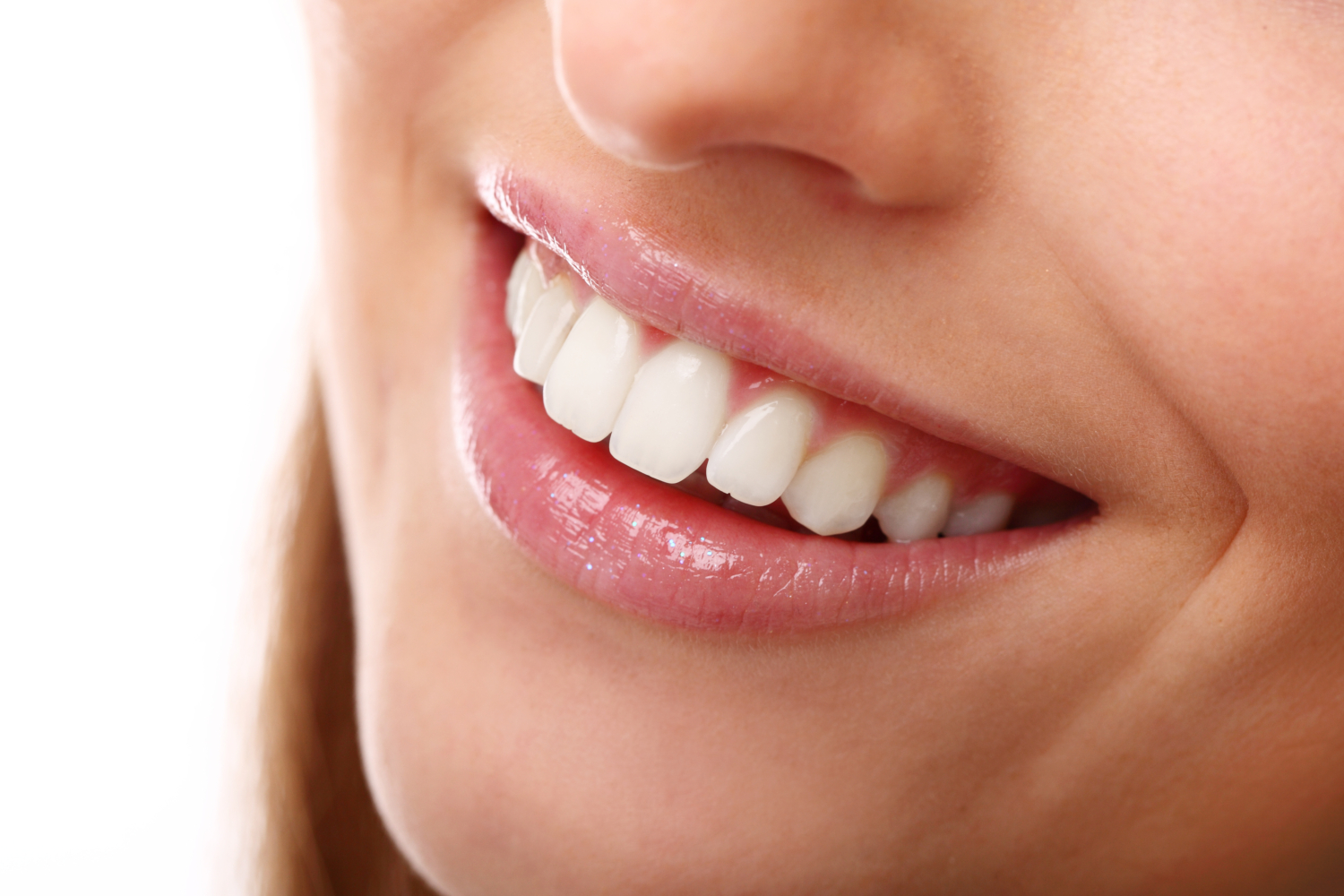 Smile Makeovers Westerhope