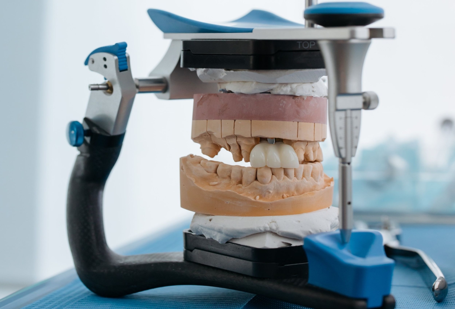 Cosmetic Dentistry Newcastle
