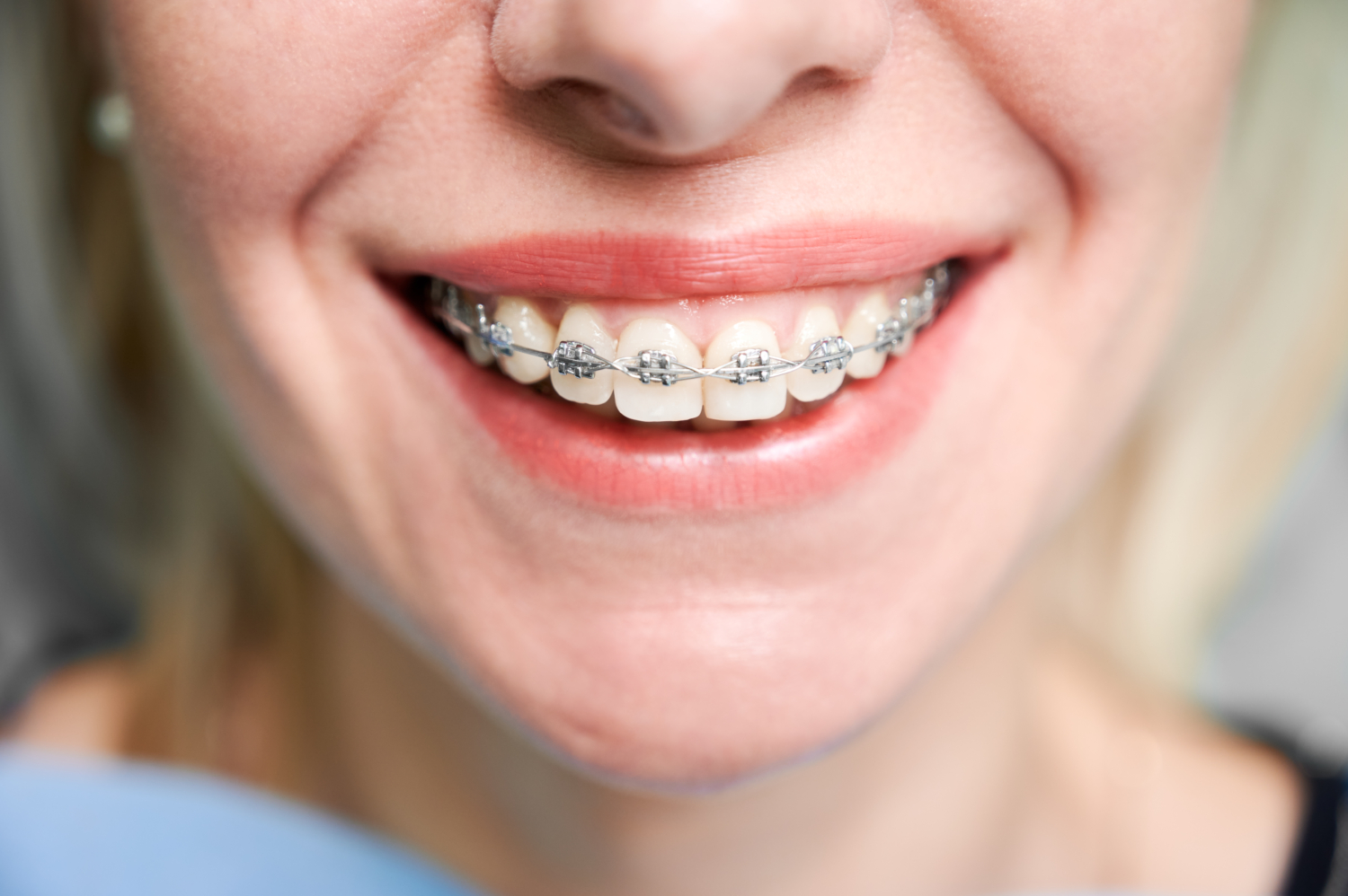 Cosmetic Dentistry in Newcastle
