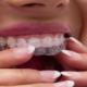 Orthodontics Newcastle