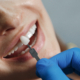 Dental Implant Treatments in Newcastle