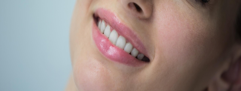 Teeth Whitening Newcastle
