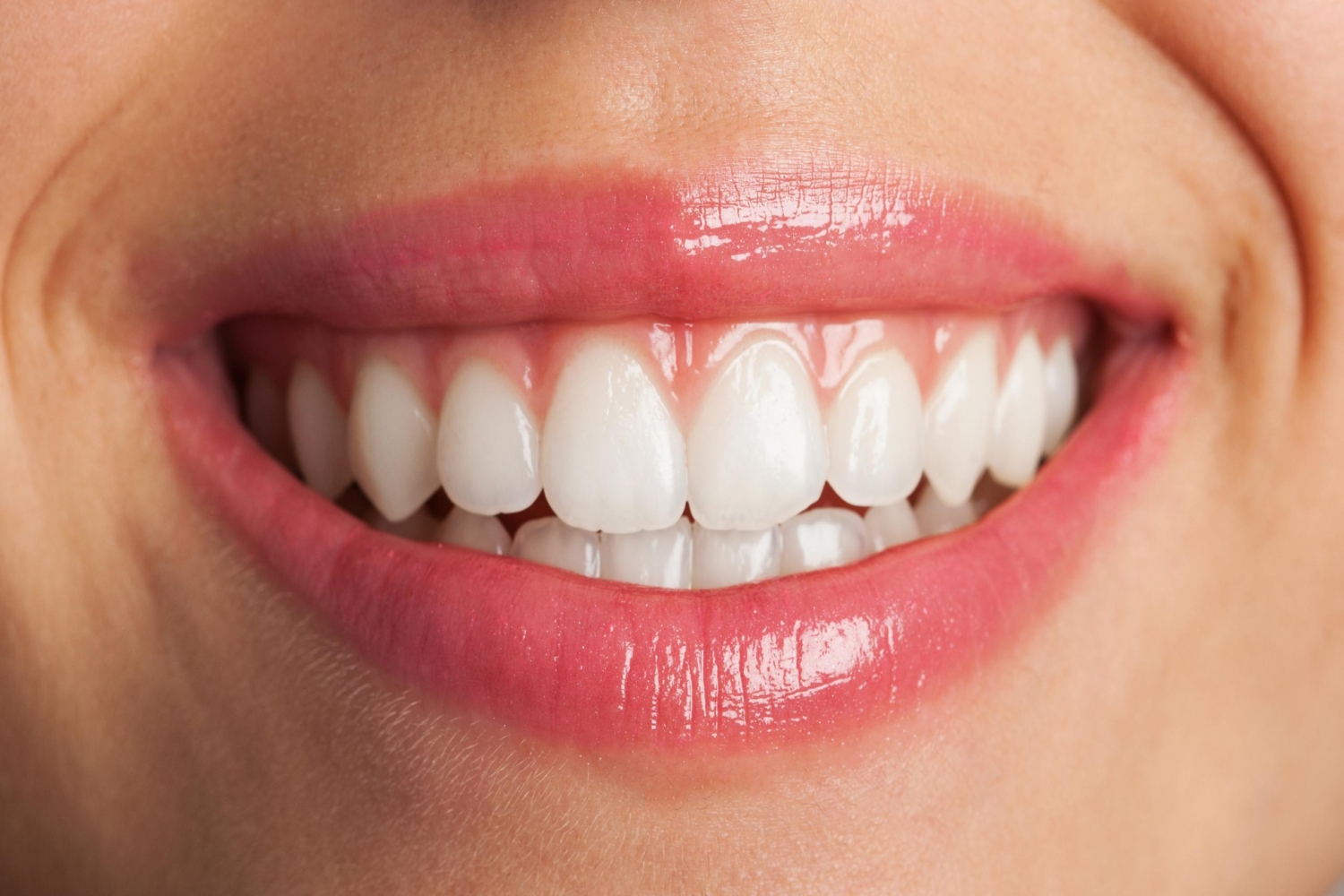 Teeth Whitening Newcastle