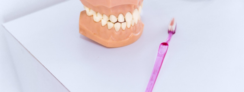 Dental Implants Newcastle
