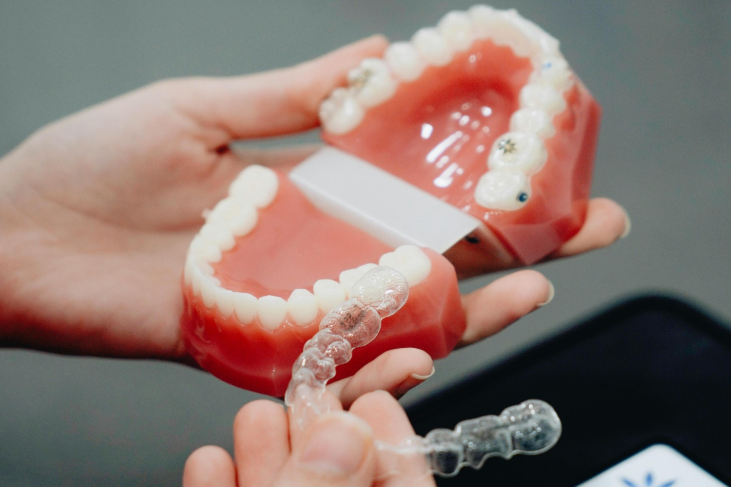 Orthodontics Newcastle