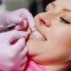 Cosmetic Dentistry Newcastle