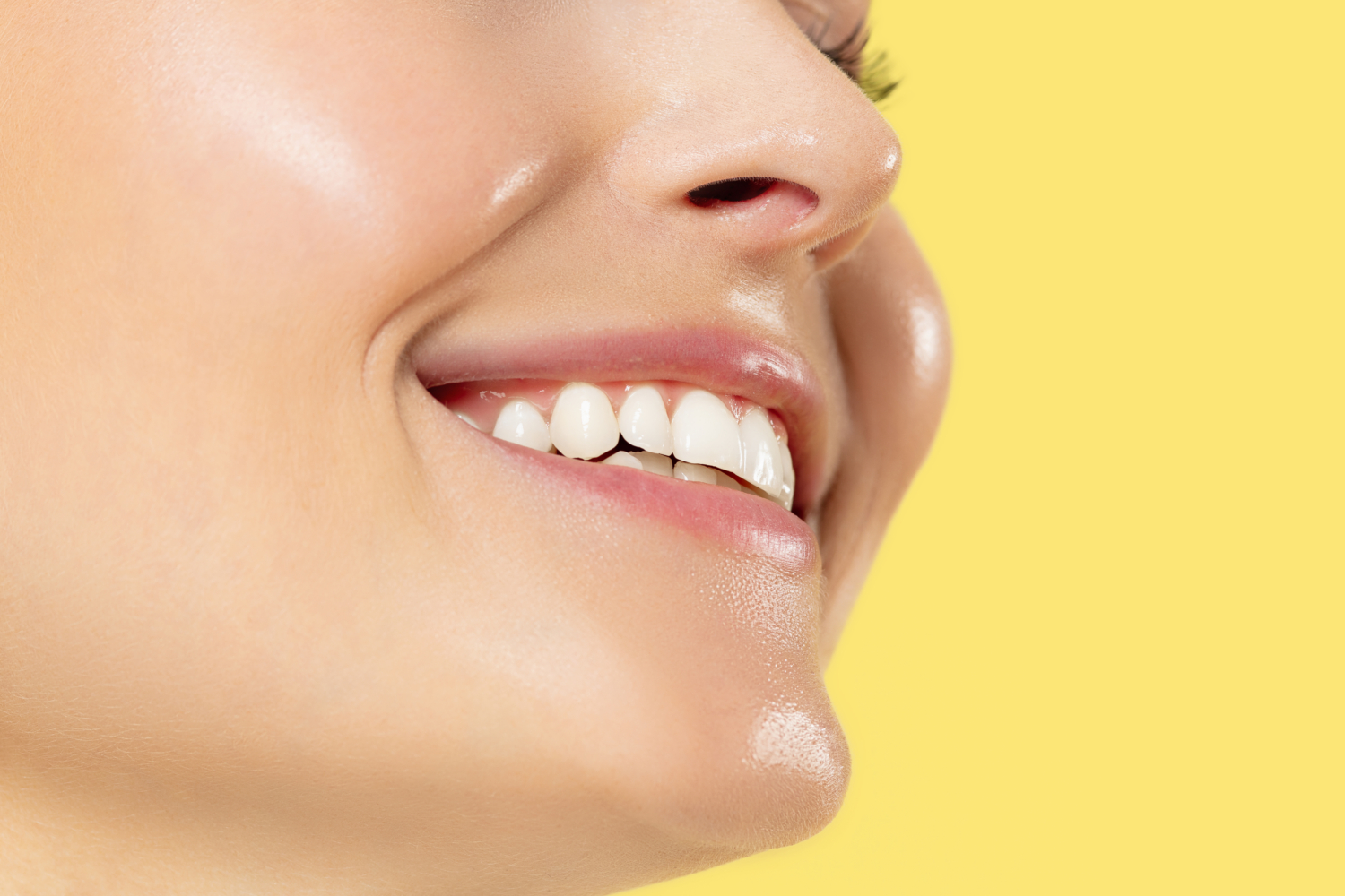 Teeth Whitening Newcastle