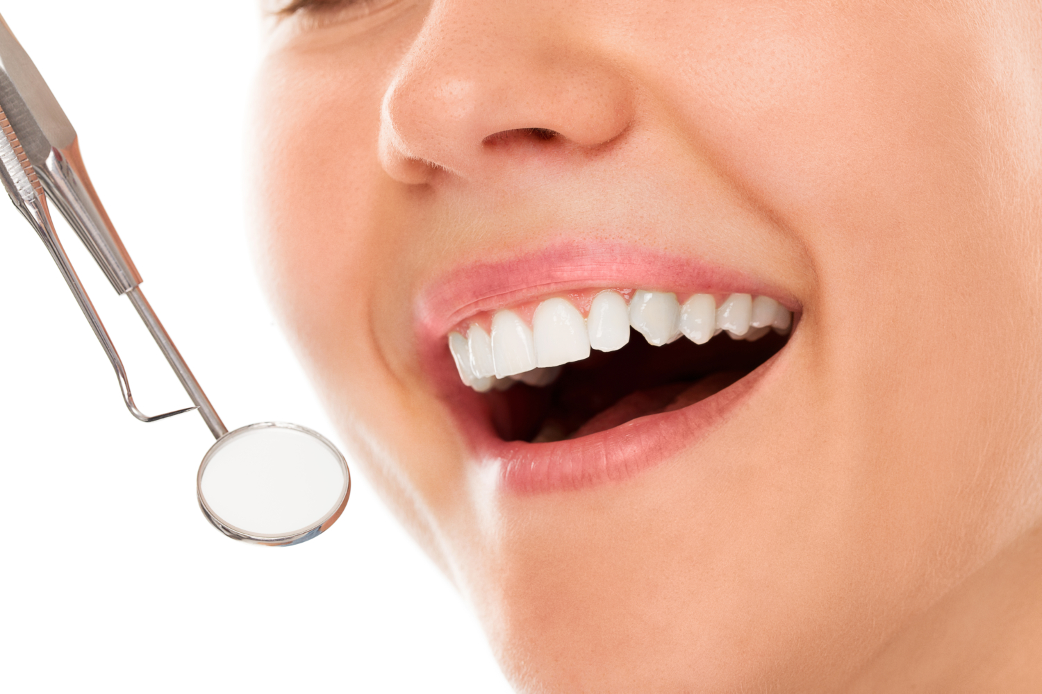 Smile Makeover Newcastle