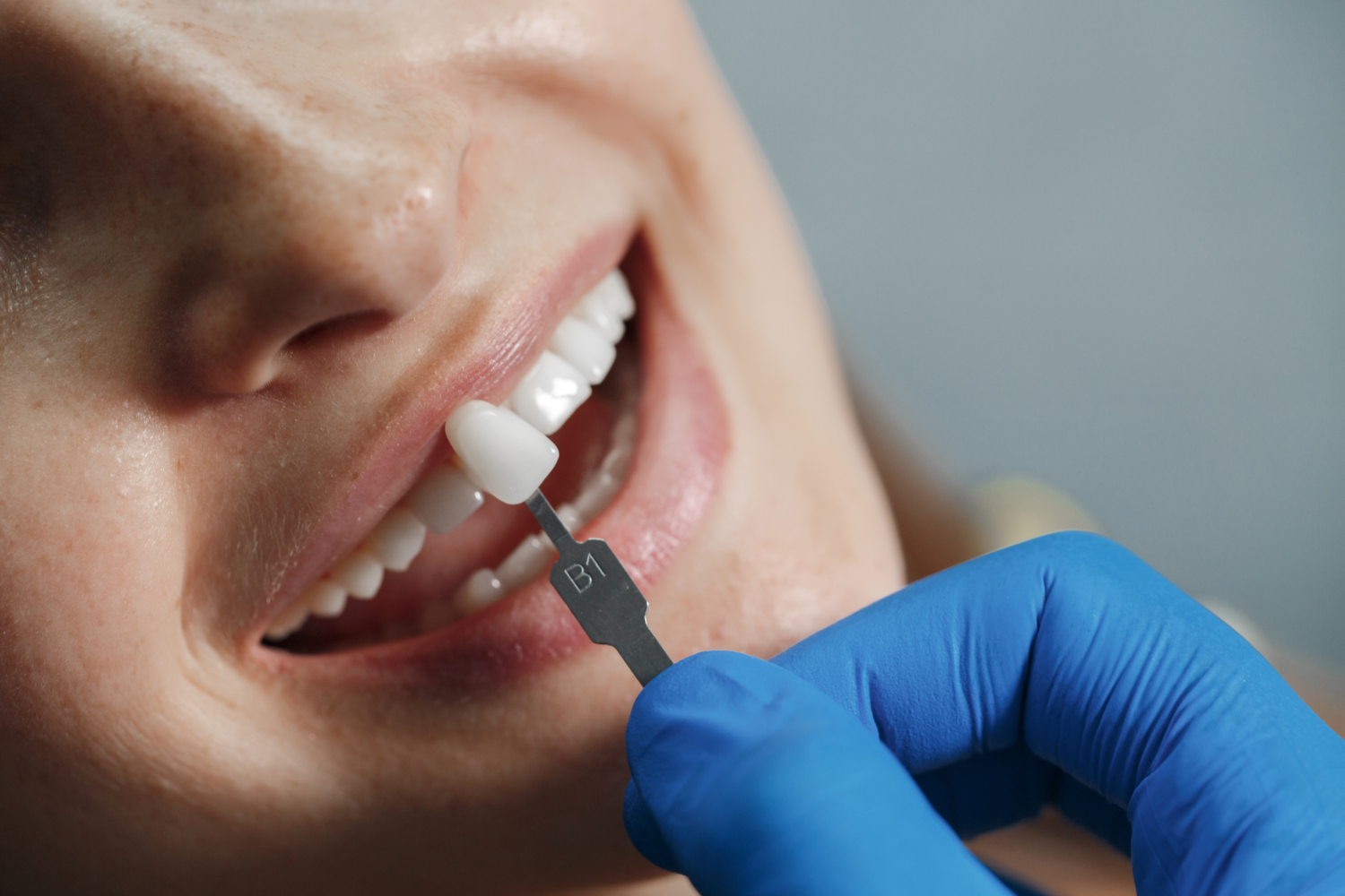 Dental Implants Newcastle