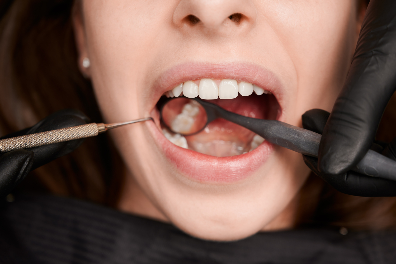 Cosmetic Dentistry Newcastle