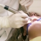 Dental Implants Newcastle What Are the Risks of Dental Implants - The Dental Care Clinic - Dentist Orthodontics Teeth Whitening in Newcastle Upon Tyne - North East