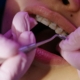 Orthodontics Braces Newcastle: How Do I Know If I Need Orthodontics Treatment?The Dental Care Clinic - Dentist Orthodontics Teeth Whitening in Newcastle Upon Tyne - North East