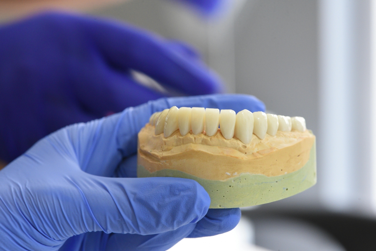 Dental Implants Newcastle Do Dental Implants Look and Feel Like Natural Teeth - The Dental Care Clinic - Dentist Orthodontics Teeth Whitening in Newcastle Upon Tyne - North East