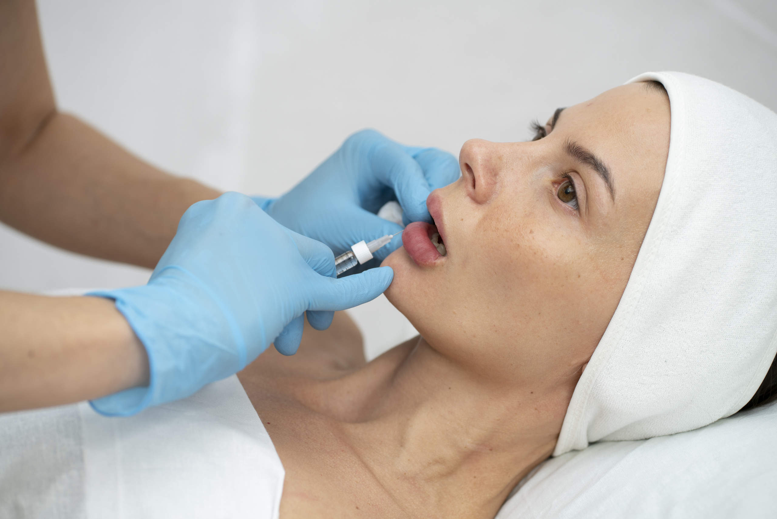 Lip Fillers in Newcastle: An Effective Way to Enhance Your Facial Aesthetics - The Dental Care Clinic - Dentist Orthodontics Teeth Whitening in Newcastle Upon Tyne - North East