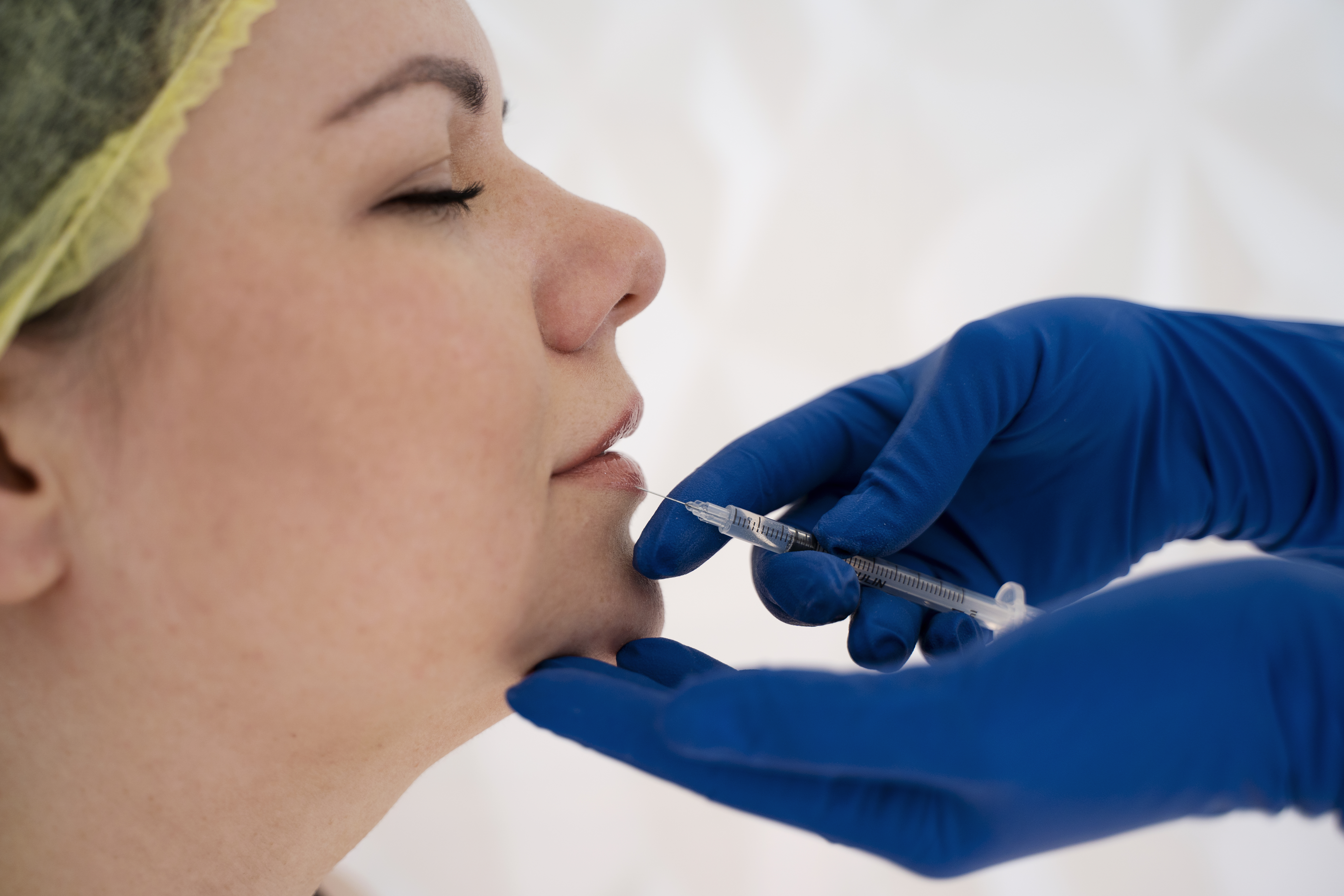 Where Can You Find the Best Private Dentist in Newcastle for Lip Fillers? - Dentist Orthodontics Teeth Whitening in Newcastle Upon Tyne - North East
