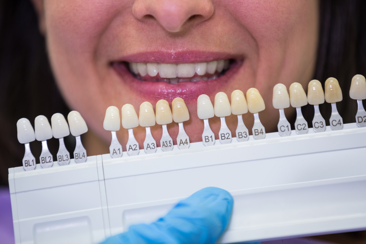 Cosmetic Dentistry in Newcastle: How Many Treatments are Included in Cosmetic Dentistry?
