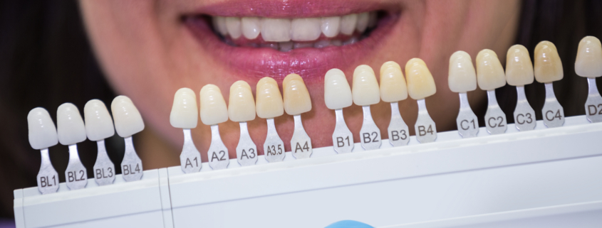 Cosmetic Dentistry in Newcastle: How Many Treatments are Included in Cosmetic Dentistry?